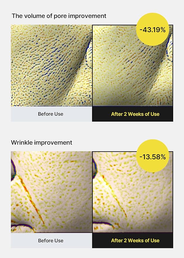 Hoygi | Retinol Shot Tightening Serum