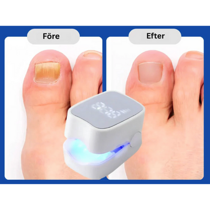 ReviNail™ – Fri från nagelsvamp. Fri att vara du.